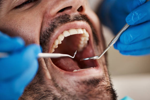 Best Pediatric Emergency Dentist in Pomona, NY