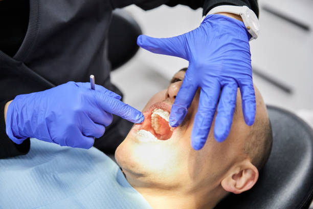 Best Emergency Dentist for Lost Fillings or Crowns in Pomona, NY